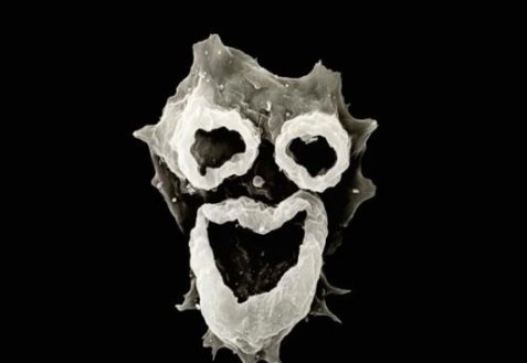 福氏耐格里变形虫有什么危害？