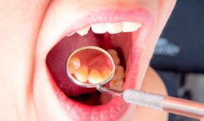 上颚的具体位置在哪