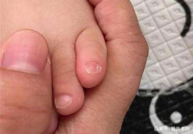 如果你的小脚趾甲是两瓣，那或许不是纯正汉人，那又是哪族人呢？