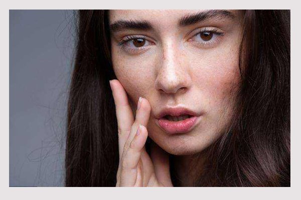 斑分为哪几种都有什么斑