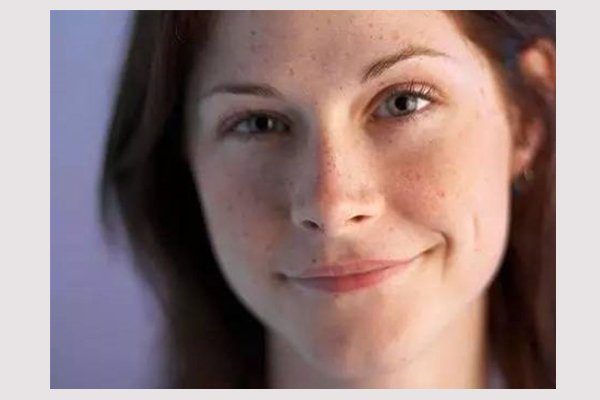 斑分为哪几种都有什么斑