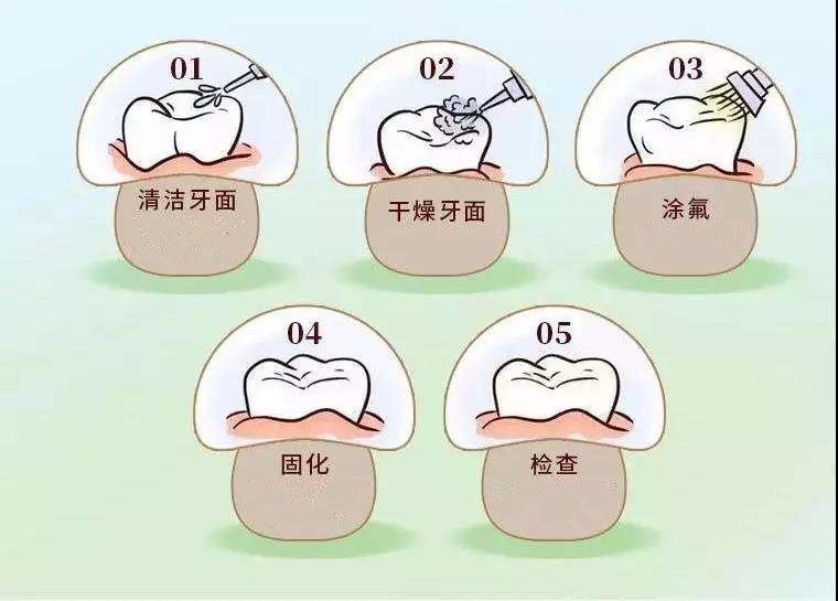 涂氟是什么意思？