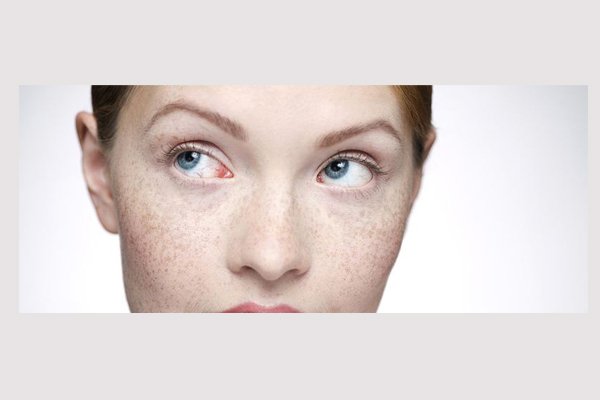 斑分为哪几种都有什么斑