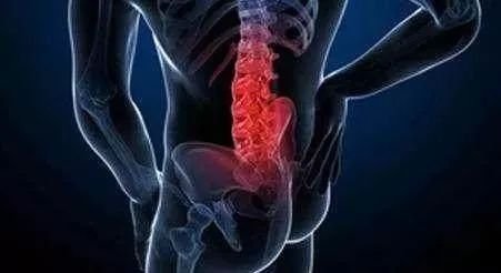 腰间盘突出是怎么引起的呢？