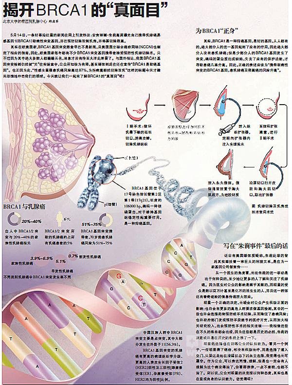 BRCA1基因的简介