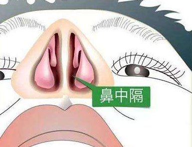 做过鼻中隔偏曲手术的谈谈手术过程