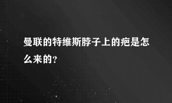 曼联的特维斯脖子上的疤是怎么来的？