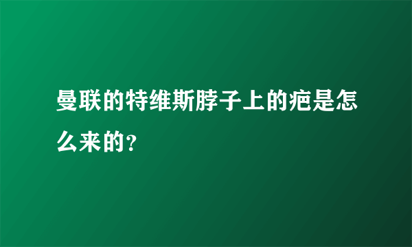 曼联的特维斯脖子上的疤是怎么来的？