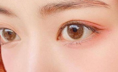 上海医生隔栅栏给被隔离女子双眼皮拆线,做了双眼皮之后多久就可以拆线了?