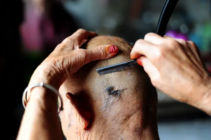 新华社暗访植发市场,这其中有哪些猫腻?