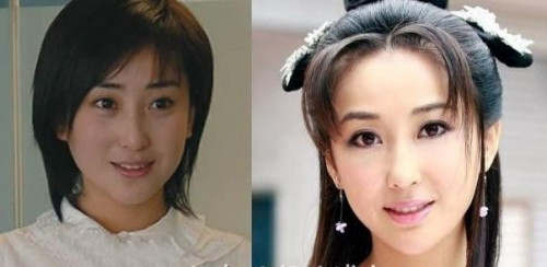 杜若溪脸怎么回事杜若溪整容前后照片对比