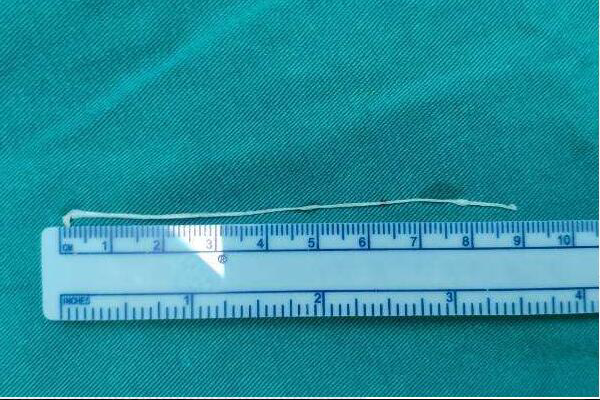 5毫米等于多少厘米？