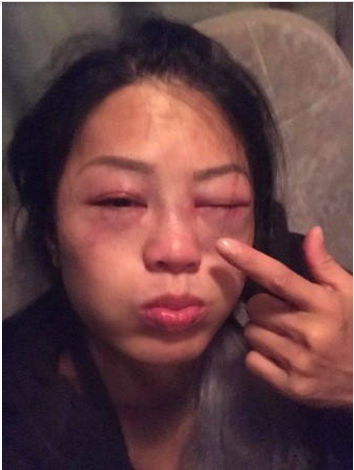 女星录节目为什么会被暴打?