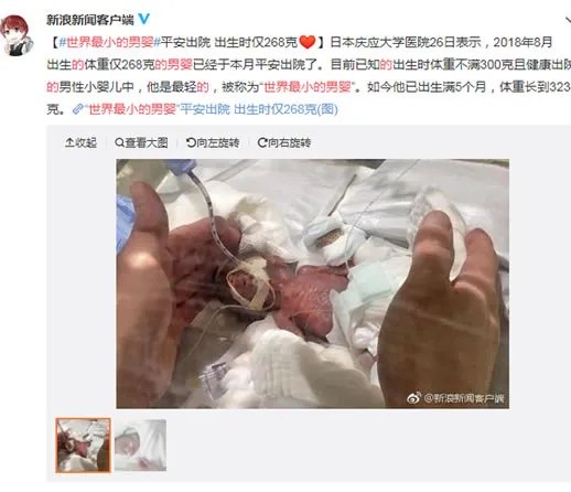 世界最小男婴有多小及照片：详情真相曝光（图）