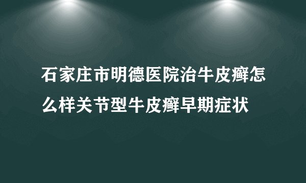 石家庄市明德医院治牛皮癣怎么样关节型牛皮癣早期症状