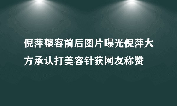 倪萍整容前后图片曝光倪萍大方承认打美容针获网友称赞
