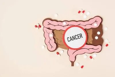 大肠类癌有哪些症状 不同类型大肠类癌症状各异