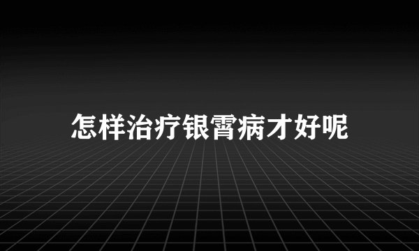 怎样治疗银霄病才好呢