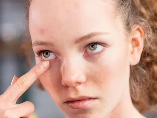 眼角长斑怎么办