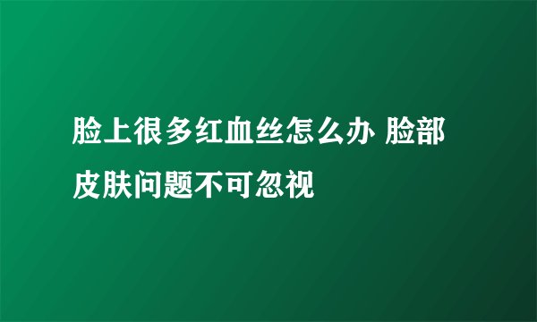 脸上很多红血丝怎么办 脸部皮肤问题不可忽视