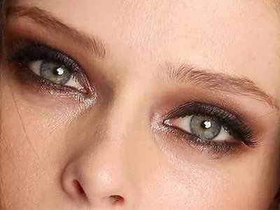 做开眼角手术要多少钱