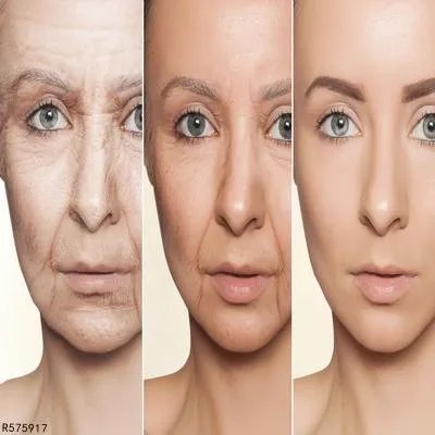 下眼睑皮肤松弛怎么回事