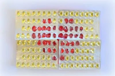 如何预防脑血栓形成 教你六大招轻松预防预防脑血栓形成