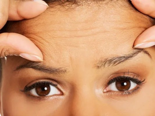 快速去除皱纹的方法有哪些