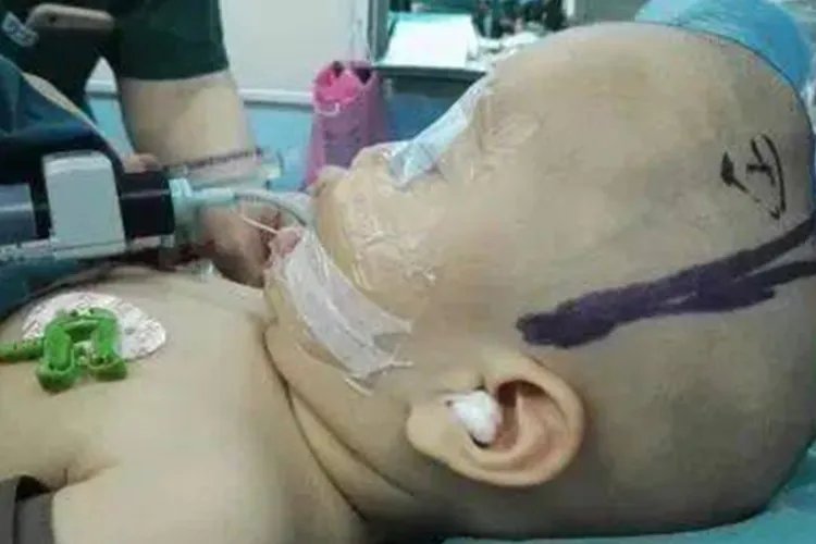 佝偻病的早期症状图片