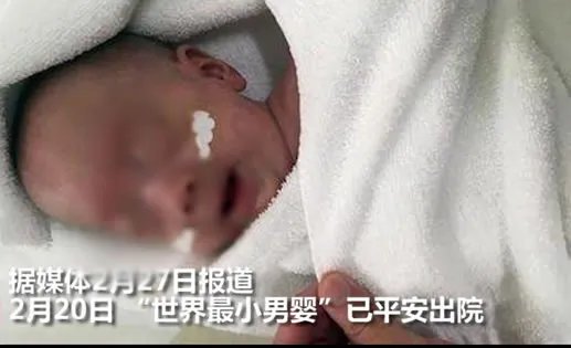 世界最小男婴有多小及照片：详情真相曝光（图）