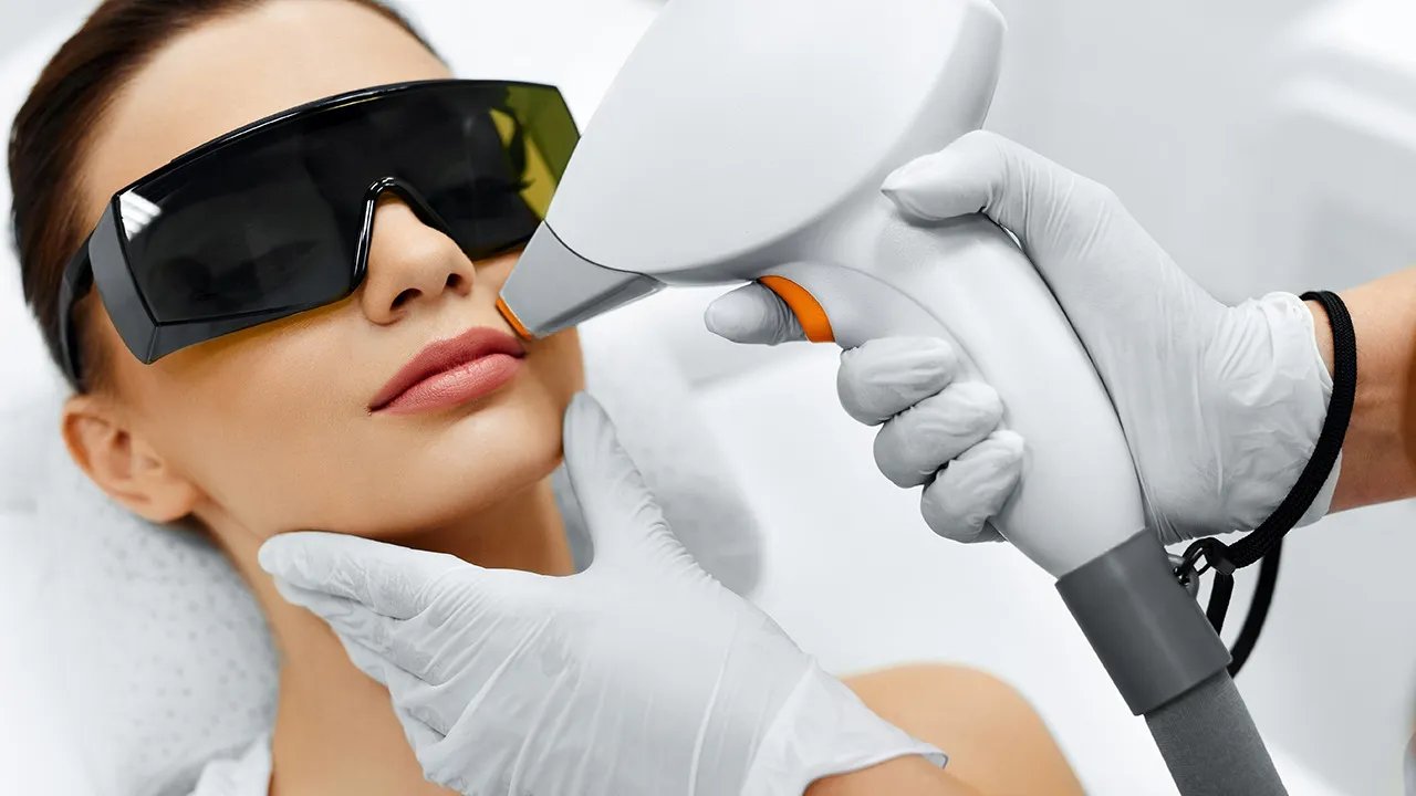 哪种激光祛斑效果好