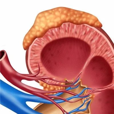 肾癌术后肌酐高怎么办