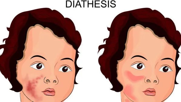 后背长痤疮怎么办