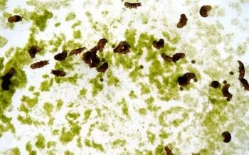 水熊虫和水仙花哪个生命力更强 水熊虫的生命力更强