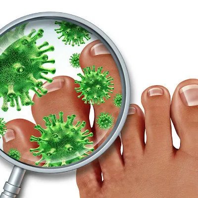 鸡眼和寻常疣的区别？