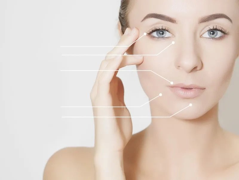 光子嫩肤治疗红血丝