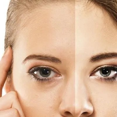 额头皮肤粗糙怎么办