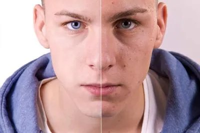 男人如何保养脸部皮肤