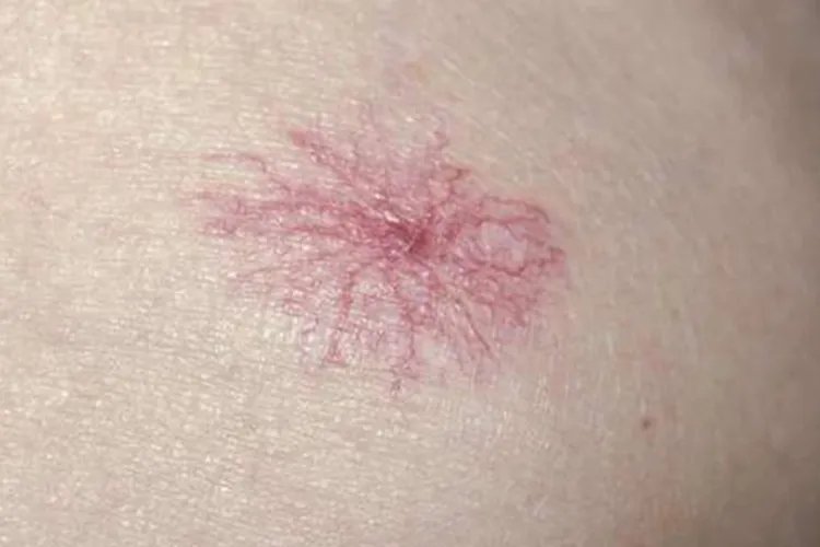 皮肤有什么症状图片