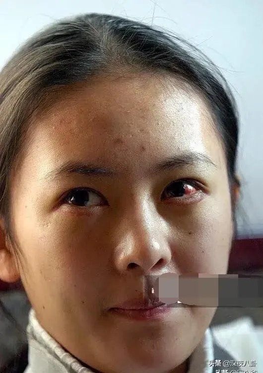 童瑶和章子怡为什么长的这么像