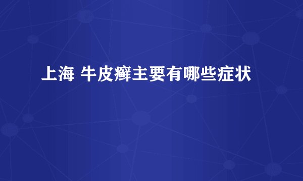 上海 牛皮癣主要有哪些症状