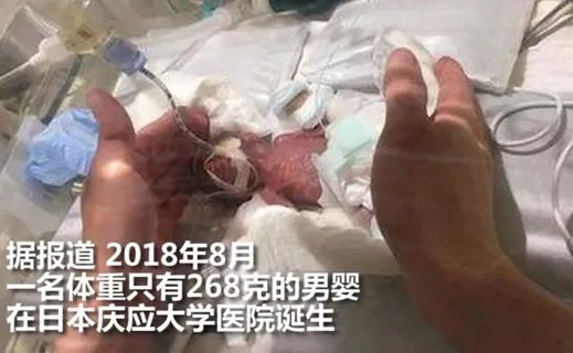 世界最小男婴有多小及照片：详情真相曝光（图）