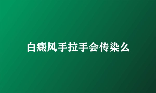 白癜风手拉手会传染么