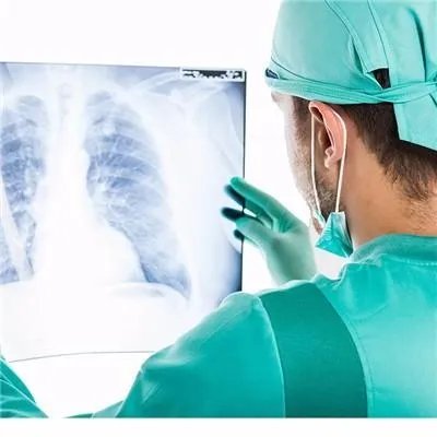 伽玛刀治疗肝癌好不好