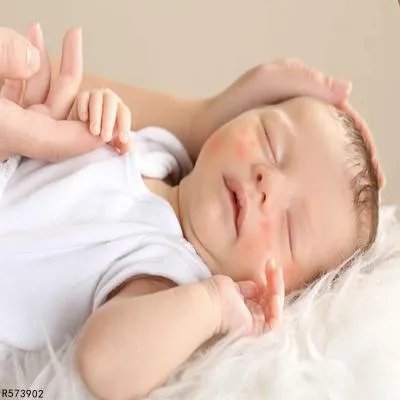 宝宝脸上起了红疙瘩怎么回事