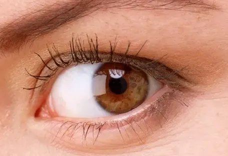 切割双眼皮要多少钱啊