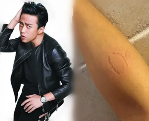 微博中邓超晒被家暴照片 网友说娘娘终于出手了