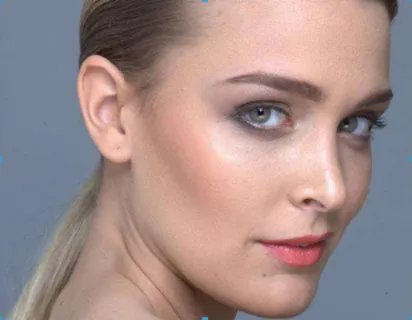 欧式双眼皮多少钱