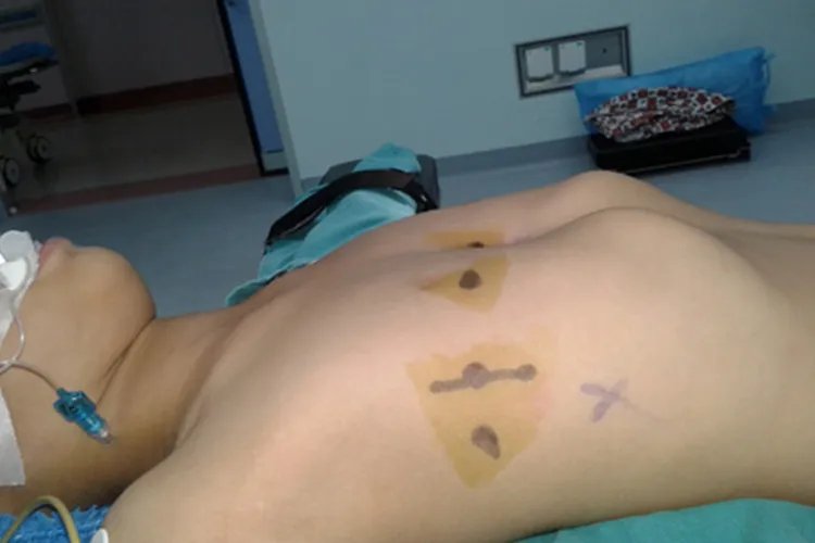 佝偻病的早期症状图片