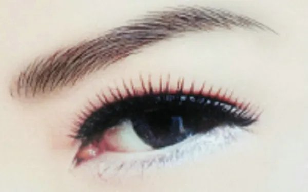 什么是韩式提眉术?